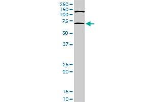 MAPKAPK2 monoclonal antibody (M08), clone 3B8. (MAPKAP Kinase 2 antibody  (AA 266-352))