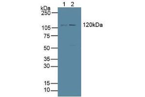 Figure. (PTPRH antibody  (AA 844-1096))