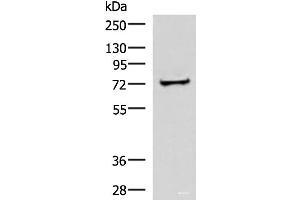 Western blot analysis of Human liver tissue lysate using ZNF263 Polyclonal Antibody at dilution of 1:500 (ZNF263 antibody)