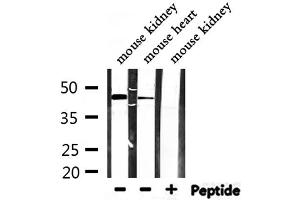 Western blot analysis of extracts from mouse kidney,mouse heart, using SYT13 Antibody. (SYT13 antibody  (Internal Region))
