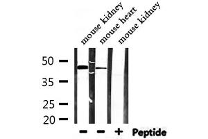 Western blot analysis of extracts from mouse kidney,mouse heart, using SYT13 Antibody.