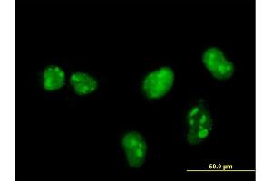 Immunofluorescence of monoclonal antibody to MKNK1 on HeLa cell. (MKNK1 antibody  (AA 1-465))