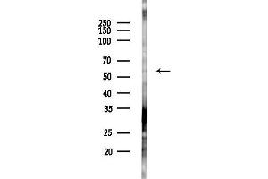 anti-Pyruvate Kinase, Liver and RBC (PKLR) (Internal Region) antibody
