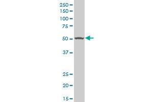 TGFBR1 polyclonal antibody (A01), Lot # ABNOVA060606QCS1 Western Blot analysis of TGFBR1 expression in HepG2 . (TGFBR1 antibody  (AA 30-125))