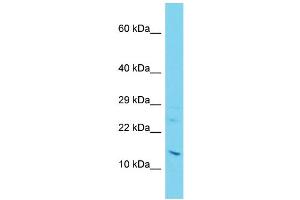 Host: Rabbit Target Name: C11orf1 Sample Type: Jurkat Whole Cell lysates Antibody Dilution: 1. (C11orf1 antibody  (C-Term))