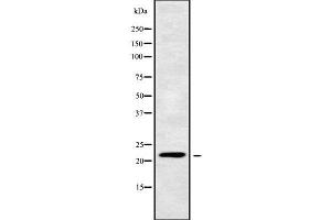 Western blot analysis of CIB4 using MCF7 whole cell lysates (CIB4 antibody  (C-Term))