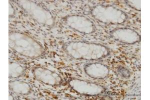 Image no. 3 for anti-Selenophosphate Synthetase 2 (SEPHS2) (AA 61-151) antibody (ABIN599185) (SEPHS2 antibody  (AA 61-151))