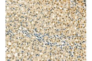 ABIN6259857 and ABIN6266711 at 1/100 staining Mouse brain tissue by IHC-P. (AKAP8 antibody  (Internal Region))