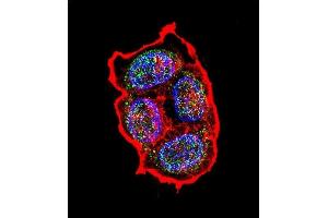 Confocal immunofluorescent analysis of AVP Antibody (Center) (ABIN651748 and ABIN2840385) with ZR-75-1 cell followed by Alexa Fluor 488-conjugated goat anti-rabbit lgG (green). (Vasopressin antibody  (AA 102-129))