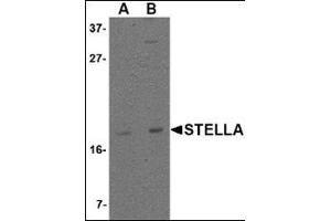 Western blot analysis of Stella in 293 cell lysate with this product at (A) 1 and (B) 2 μg/ml. (STELLAR/DPPA3 antibody  (C-Term))