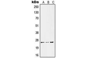 Western blot analysis of Kallikrein 11 expression in HeLa LPS-treated (A), SP2/0 UV-treated (B), PC12 LPS-treated (C) whole cell lysates. (Kallikrein 11 antibody  (Center))