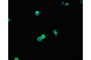 Immunofluorescent analysis of HepG2 cells using ABIN7145646 at dilution of 1:100 and Alexa Fluor 488-congugated AffiniPure Goat Anti-Rabbit IgG(H+L) (DBC1 antibody  (AA 20-320))