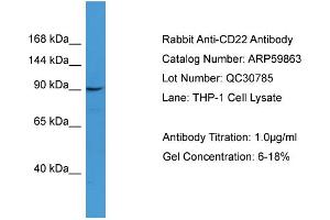 WB Suggested Anti-CD22  Antibody Titration: 0. (CD22 antibody  (N-Term))
