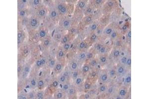 IHC-P analysis of Mouse Tissue, with DAB staining. (ABCA13 antibody  (AA 4692-4931))
