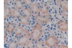 Detection of PDHX in Mouse Kidney Tissue using Polyclonal Antibody to Pyruvate Dehydrogenase Complex Component X (PDHX) (PDHX antibody  (AA 222-471))
