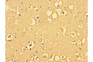 Immunohistochemistry of paraffin-embedded human brain tissue using ABIN7153215 at dilution of 1:100 (ALDOC antibody  (AA 190-354))