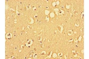 Immunohistochemistry of paraffin-embedded human brain tissue using ABIN7153215 at dilution of 1:100 (ALDOC antibody  (AA 190-354))