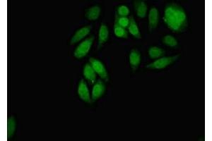 Immunofluorescent analysis of A549 cells using ABIN7159096 at dilution of 1:100 and Alexa Fluor 488-congugated AffiniPure Goat Anti-Rabbit IgG(H+L) (MDC1 antibody  (AA 1892-2082))