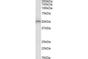 ABIN1590032 (1 µg/mL) staining of Human Skeletal Muscle lysate (35 µg protein in RIPA buffer). (Fascin antibody  (Internal Region))