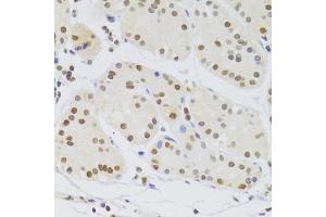 Immunohistochemistry of paraffin-embedded human stomach using HNRNPA1 Antibody (ABIN5975570) at dilution of 1/100 (40x lens). (HNRNPA1 antibody)
