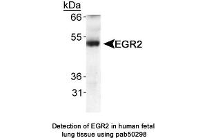 Image no. 1 for anti-Early Growth Response 2 (EGR2) (AA 200-300) antibody (ABIN363607) (EGR2 antibody  (AA 200-300))