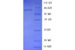 SDS-PAGE (SDS) image for Heterogeneous Nuclear Ribonucleoprotein D (HNRNPD) (AA 18-355), (partial) protein (GST tag) (ABIN4976327)