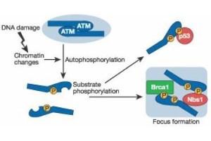 Image no. 2 for anti-Ataxia Telangiectasia Mutated (ATM) (pSer1981) antibody (ABIN401482) (ATM antibody  (pSer1981))