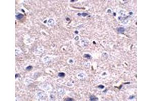 Immunohistochemistry (IHC) image for anti-Programmed Cell Death 1 (PDCD1) antibody (ABIN492542) (PD-1 antibody)