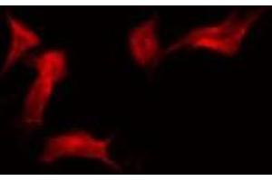 ABIN6275485 staining HuvEc by IF/ICC. (RFPL4A antibody  (Internal Region))