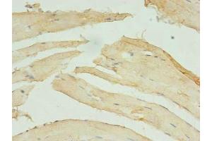 Immunohistochemistry of paraffin-embedded human skeletal muscle tissue using ABIN7171221 at dilution of 1:100 (STX1A antibody  (AA 2-228))