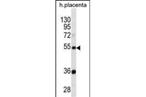 TEKT3 Antibody (N-term) (ABIN1881875 and ABIN2838434) western blot analysis in human placenta tissue lysates (35 μg/lane). (Tektin 3 antibody  (N-Term))