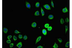 Immunofluorescent analysis of A549 cells using ABIN7164562 at dilution of 1:100 and Alexa Fluor 488-congugated AffiniPure Goat Anti-Rabbit IgG(H+L) (ZDHHC1 antibody  (AA 283-389))