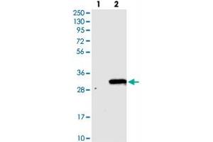 Western blot analysis of Lane 1: Negative control (vector only transfected HEK293T lysate), Lane 2: Over-expression Lysate (Co-expressed with a C-terminal myc-DDK tag (~3. (TVP23C/FAM18B2 antibody)