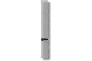 21 kDa (RAC1 antibody)