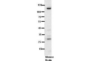 WB Suggested Anti-N6AMT1 Antibody Titration:  5% Milk  ELISA Titer:  dilution: 1:500  Positive Control:  Mouse Brain lysate (N6AMT1 antibody  (N-Term))