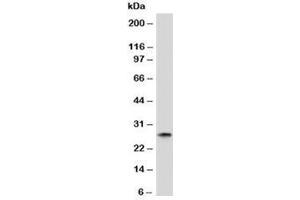 Western blot analysis of human spleen tissue and Kappa antibody. (Mouse anti-Human Immunoglobulin kappa Chain Complex (Igk) Antibody)