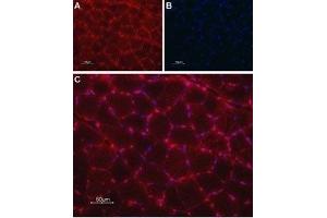 Expression of TRIC-A in rat skeletal muscle - Immunohistochemical staining of paraffin-embedded rat skeletal muscle sections using Anti-TRIC-A (TMEM38A) Antibody (ABIN7043861 and ABIN7045315), followed by goat anti-rabbit-AlexaFluor-594 secondary antibody. (TMEM38A antibody  (C-Term, Intracellular))