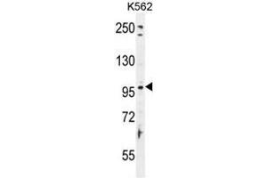 TAS1R2 Antibody (C-term) western blot analysis in K562 cell line lysates (35µg/lane). (TAS1R2 antibody  (C-Term))