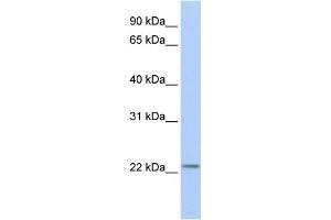WB Suggested Anti-HIST1H1T Antibody Titration: 0. (Histone Cluster 1, H1t (HIST1H1T) (Middle Region) antibody)