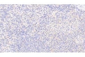 Immunohistochemistry (IHC) image for anti-Glucose-6-Phosphate Dehydrogenase (G6PD) antibody (ABIN7432451)