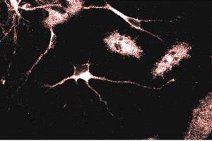 Immunofluorescent staining of Rat Neurons with anti-Adaptin gamma antibody.