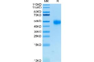 Human CD38 on Tris-Bis PAGE under reduced condition. (CD38 Protein (AA 43-300) (His tag))