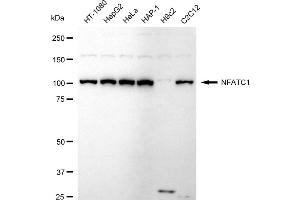 Western blotting analysis using NFATC1 antibody (ABIN7799636).