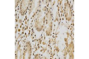 Immunohistochemistry of paraffin-embedded human stomach using HDAC6 antibody (ABIN5997884) at dilution of 1/100 (40x lens). (HDAC6 antibody)