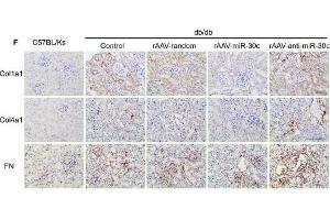 MiR-30c reduced fibrosis in DN via reducing TGF-β1 secretion from TECs. (COL4A1 antibody  (AA 1445-1669))