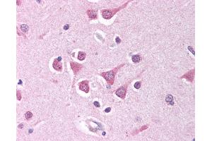 Anti-PPP4C antibody IHC of human brain, cortex. (PPP4C antibody  (AA 294-307))