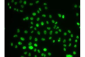 Immunofluorescence analysis of MCF-7 cells using PHIP antibody (ABIN6129078, ABIN6145556, ABIN6145557 and ABIN6223036). (PHIP antibody  (AA 1542-1821))