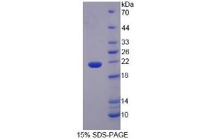 Image no. 1 for Interleukin 1 Family Member 9 (IL1F9) (AA 1-158) protein (His tag) (ABIN6237370) (IL1F9 Protein (AA 1-158) (His tag))