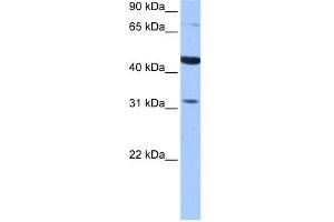 WB Suggested Anti-TPRXL Antibody Titration:  0. (TPRXL antibody  (C-Term))