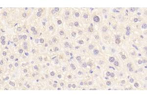 Detection of PROC in Mouse Liver Tissue using Polyclonal Antibody to Protein C (PROC) (PROC antibody  (AA 197-436))
